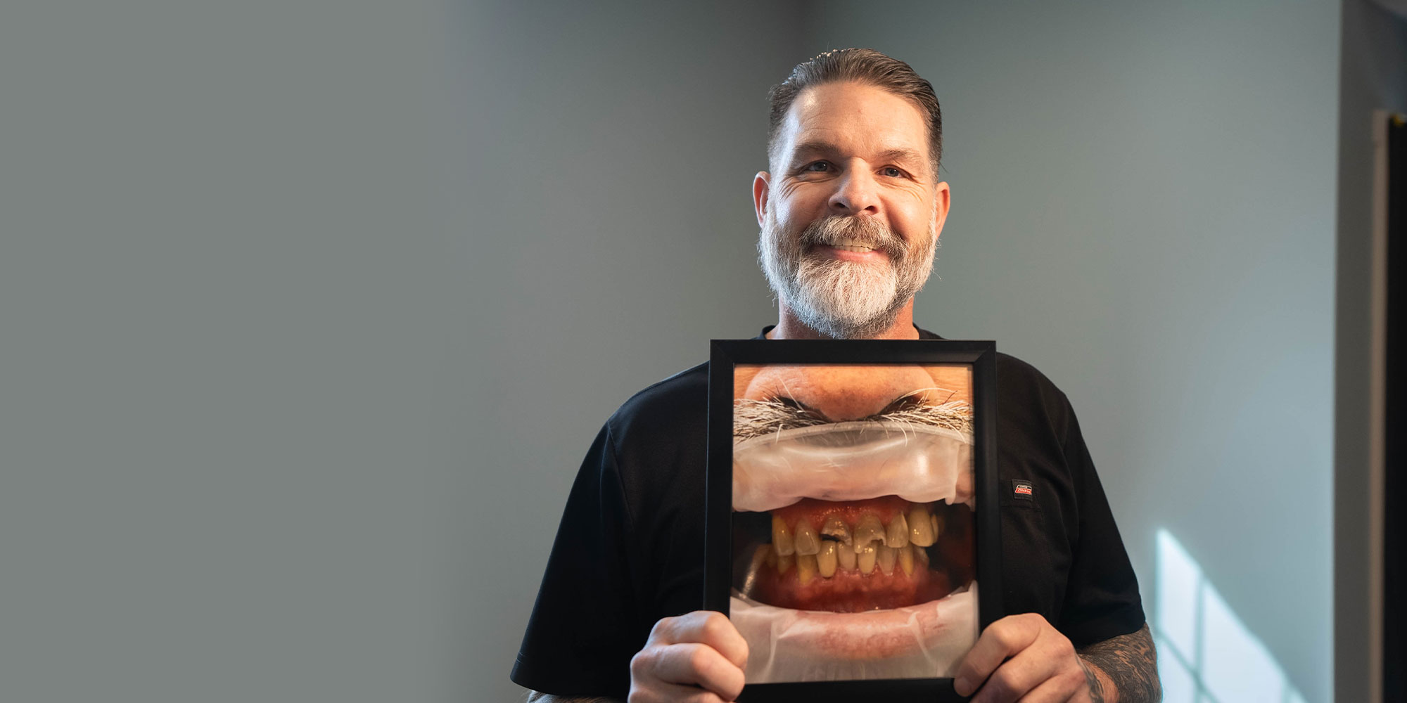 dental implant holding up a photos of their teeth before dental implants